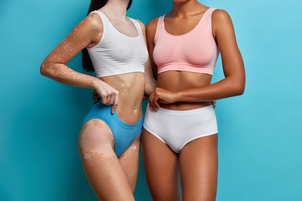 Tudo sobre Exciplex: a tecnologia para tratar vitiligo, alopecia, dermatite atópica e psoríase