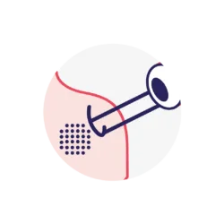 Handpiece fracionada - Discovery PICO Plus