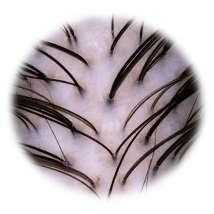 DETALHE HAIRMETRIX DETALHE HAIRMETRIX