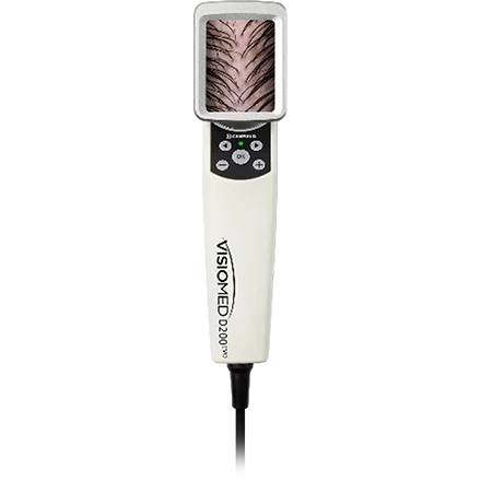 FRONT HAIRMETRIX FRONT HAIRMETRIX
