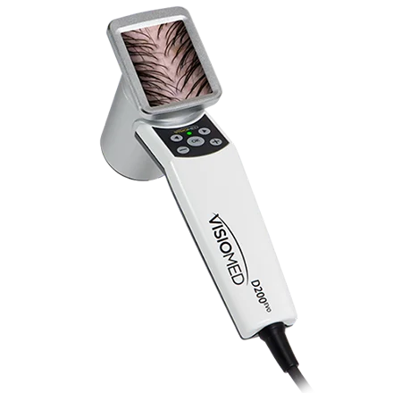 SIDE HAIRMETRIX