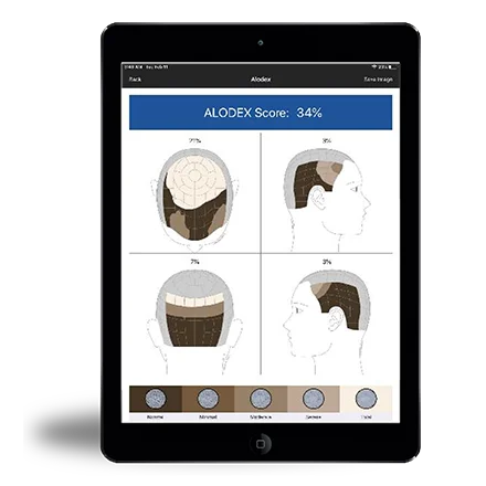 TABLET HAIRMETRIX TABLET HAIRMETRIX
