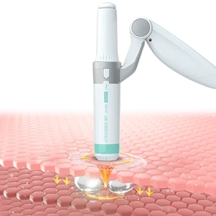 Ação DSB e Ultra Booster