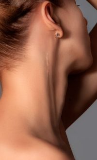 Trartamentos-tratamento-estetico-cicratrizes