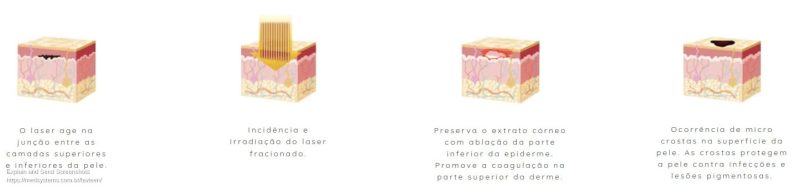 Lavieen _ Especificações técnicas e tratamentos _ Medsystems (1)