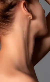 Tratamento estético de cicatrizes